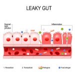 can_collagen_heal_leaky_gut