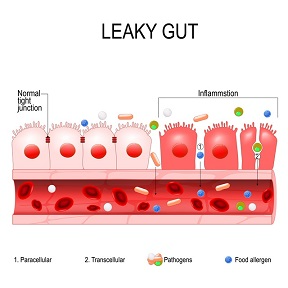 Fermented foods and leaky gut