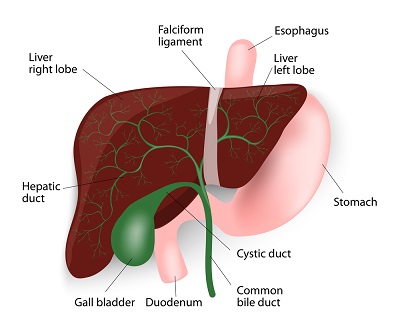 Chronic Constipation Causes due to bile stone build-up and becoming larger in size