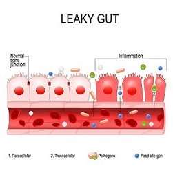 Gut Flora imbalance causes are numerous.